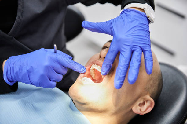 Best Chipped Tooth Repair Near Me  in Swepsonville, NC