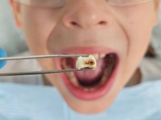 Emergency Gum Pain Relief in NC